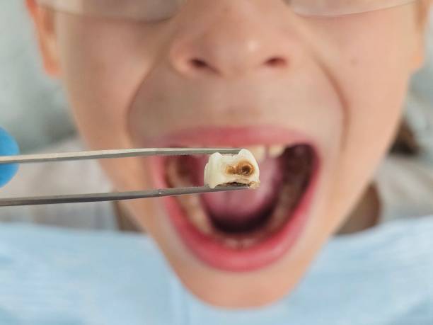 Best Urgent Care for Lost Fillings or Crowns in Lathrup Village, MI